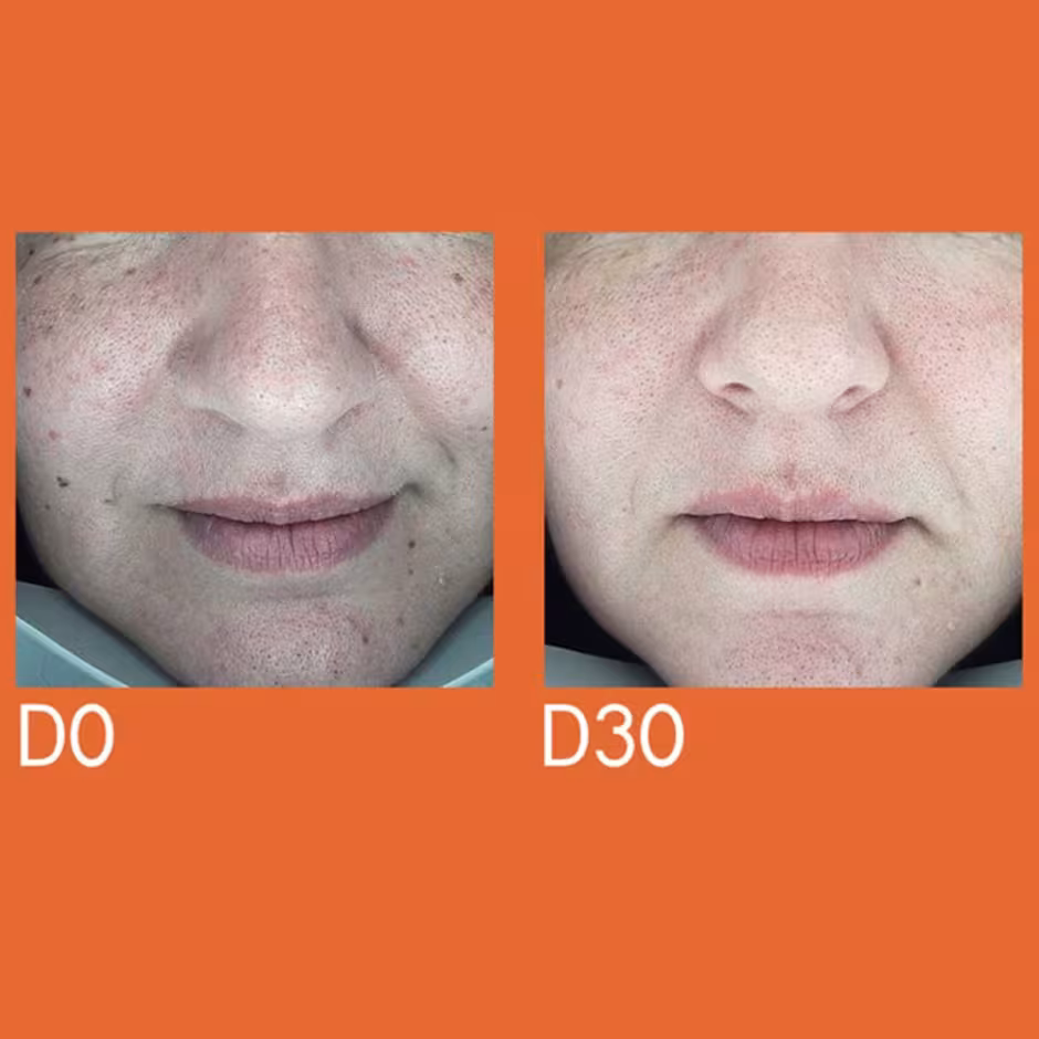 DARK SPOT REMOVER SERUM 30ml